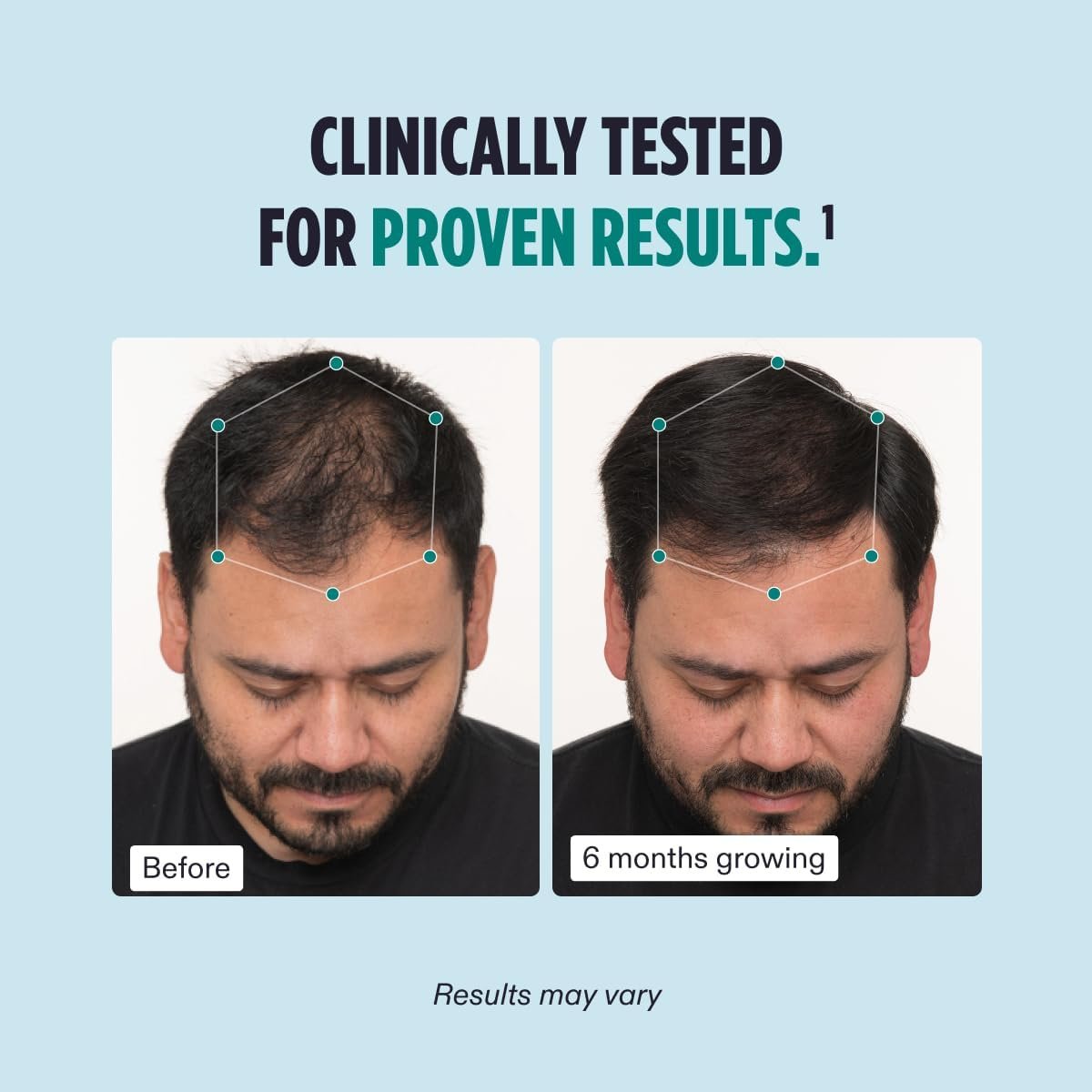 Nutrafol Men Hair Growth Supplement - black
